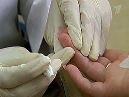 Серцевий напад можна діагностувати по одній краплі крові