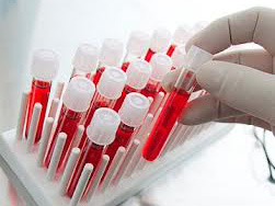 Новий тест виявить рак по крові всього за десять хвилин