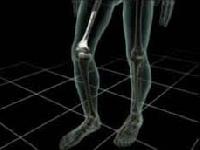 Вчені представили революційний засіб для відновлення кісток