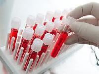 Унікальний тест може виявити ендометріоз по крові