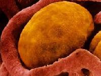 Дослідники знайшли спосіб зупинити набір ваги