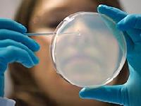 Інсульти та бактерії в ротовій порожнині пов'язані, показав аналіз