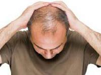 Дослідники виявили несподівані ліки від облисіння
