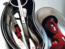 Людям почнуть пересаджувати органи свиней, прогнозують експерти