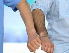 Дослідники з'ясували, завдяки чому у людей мало "рослинності" на тілі