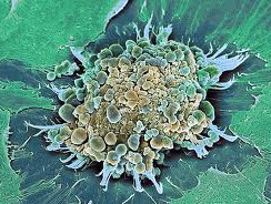 Вакцина від віспи подарувала потужний протираковий засіб