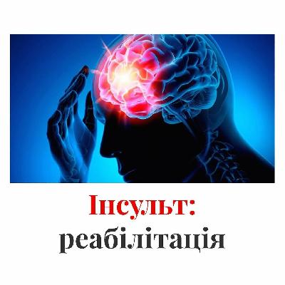 Стимуляція спинного мозку відновлює постінсультну функцію рук
