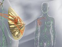 В Індії розробили неінвазивний тест, який використовує штучний інтелект для виявлення раку молочної залози