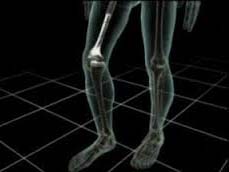 Вчені представили революційний засіб для відновлення кісток