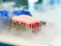 МОЗ готується до проведення дослідження наявності антитіл до Covid-19 в українців