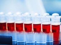 Імунітет у перехворілих на COVID-19 зберігається щонайменше півроку - дослідження Оксфордського університету