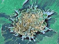 Вакцина від віспи подарувала потужний протираковий засіб